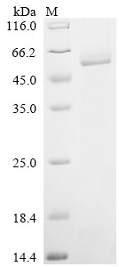 1-Acylglycerol-3-phosphate O-acyltransferase PNPLA3 (PNPLA3), partial, human, recombinant