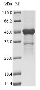 40S ribosomal protein S3 (RPS3), human, recombinant