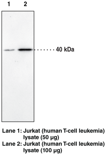 Anti-CB2 Receptor