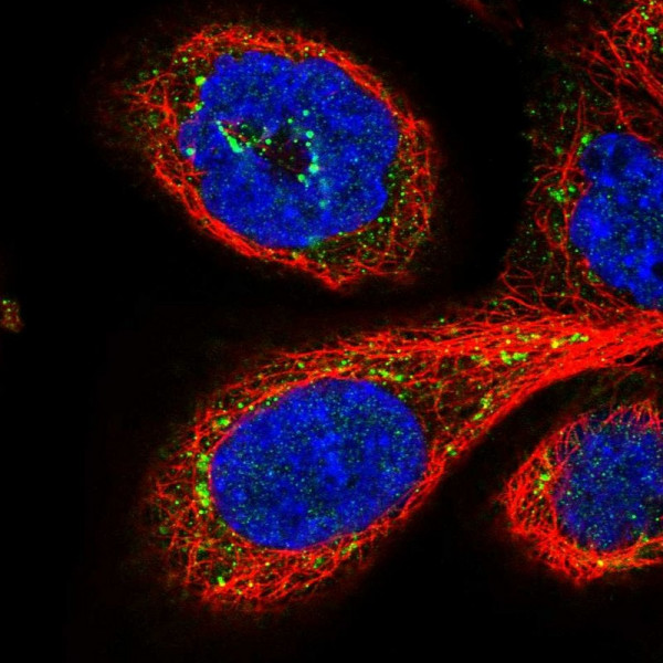 Anti-GPSM1