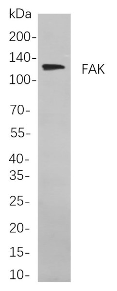 Anti-Recombinant FAK, clone 5A11