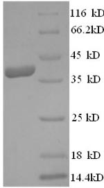 Vascular endothelial growth factor D (FIGF), human, recombinant