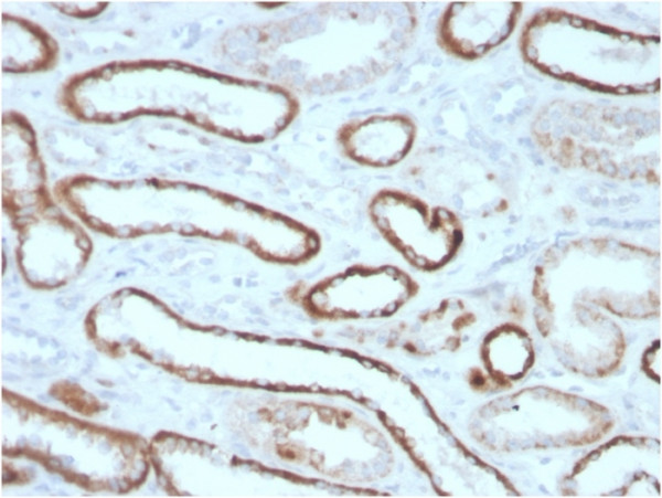 Anti-Renal Cell Carcinoma (Carbonic Anhydrase IX), clone CA9/3405