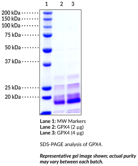 GPX4 (human, recombinant, His-tagged)