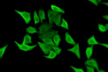 Anti-HPX / Hemopexin