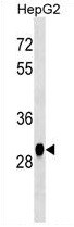 Anti-HNMT, clone 432CT31.4.2