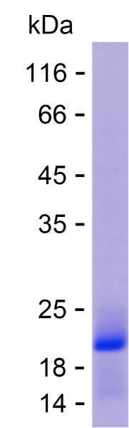 Recombinant Human HGD Protein