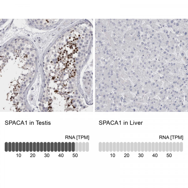 Anti-SPACA1