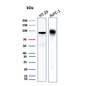 Anti-CEACAM6 / Carcinoembryonic antigen-related cell adhesion molecule 6, clone CEACAM6/13371R