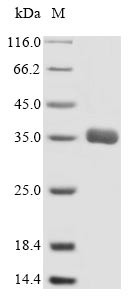 Multidrug resistance-associated protein 1 (ABCC1), partial, human, recombinant
