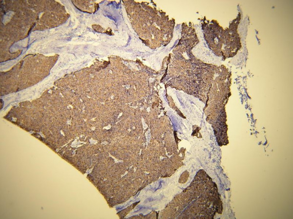 Anti-Cytokeratin 19, clone E16-L