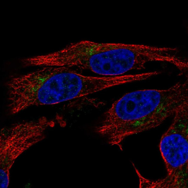 Anti-ENTPD6