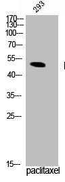 Anti-Phospho-TPH1 (S58)