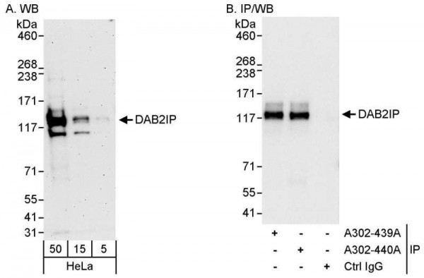 Anti-DAB2IP