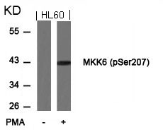 Anti-phospho-MKK6 (Ser207)