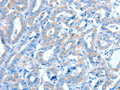 Anti-ALDH3B1