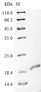 Palmitoyltransferase ZDHHC5 (ZDHHC5), partial, human, recombinant