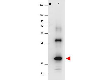 Anti-Interleukin-32A (IL-32A)