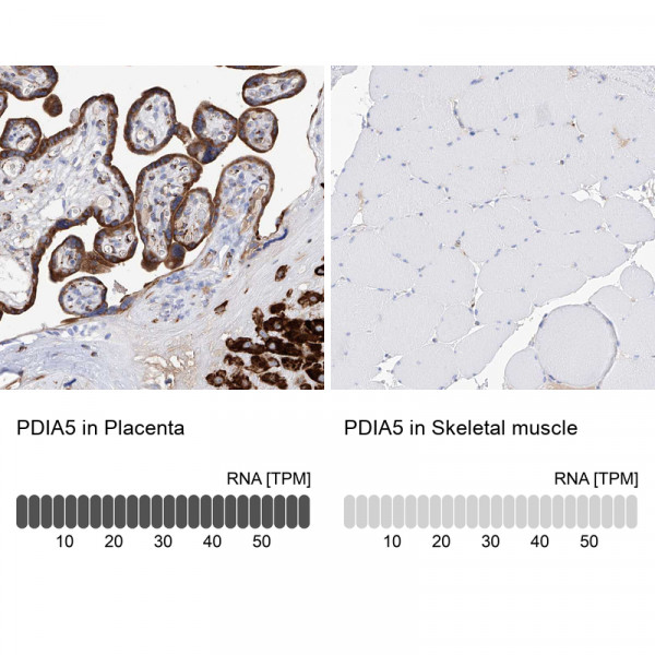 Anti-PDIA5