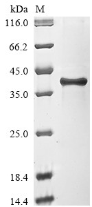 Dolichyl-phosphate-mannose--protein mannosyltransferase 1 (PMT1), partial, Saccharomyces cerevisiae,