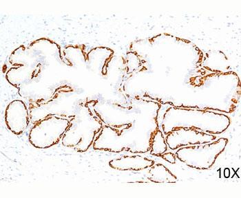 Anti-Cytokeratin 14, clone LL002