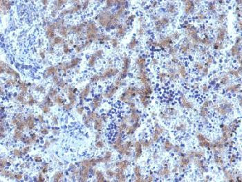 Anti-Glypican-3 (GPC3) (Hepatocellular Carcinoma Marker) (clone: GPC3/1534R) (recombinant rabbit mon
