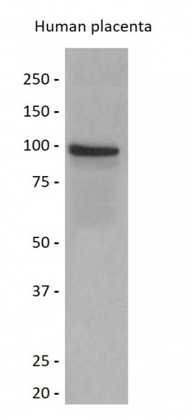 Anti-Thrombomodulin