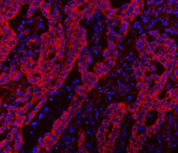 Anti-CLASP1 / CLIP-associating protein 1