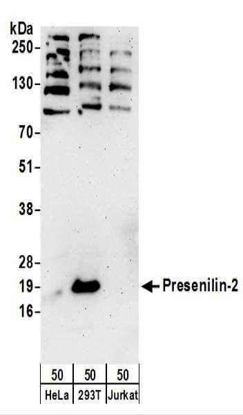 Anti-Presenilin-2
