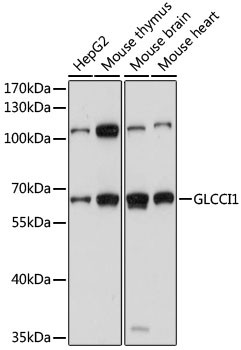 Anti-GLCCI1