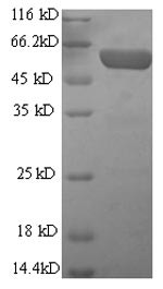 Glial fibrillary acidic protein (Gfap), mouse, recombinant