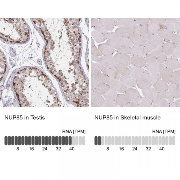 Anti-NUP85