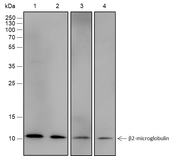 Anti-Recombinant beta-2-Microglobulin, clone A561
