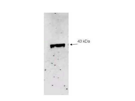 Anti-Neuraminidase (Neu2)