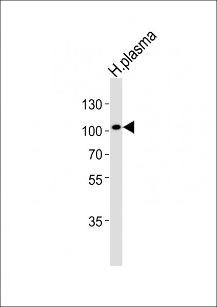 Anti-Gelsolin
