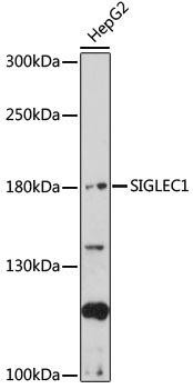 Anti-SIGLEC1