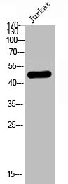Anti-Phospho-RUNX1 (S249)