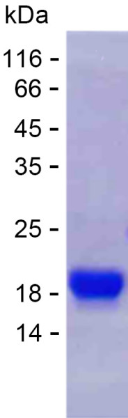 Recombinant Human ZNF705A Protein