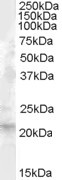 Anti-Fibroblast growth factor 21, Internal