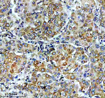 Anti-VASP / Vasodilator stimulated phosphoprotein, clone BHO-22