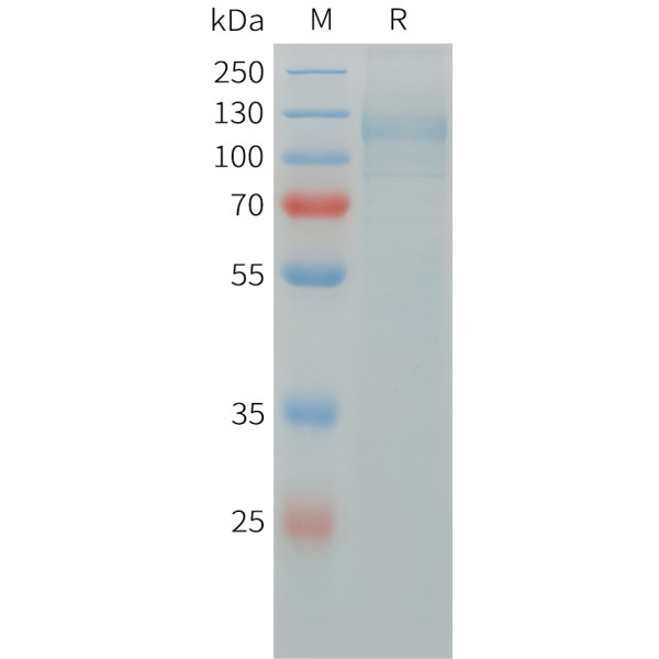 Human ITGAV and ITGB5 Heterodimer Protein, His Tag and hFc Tag