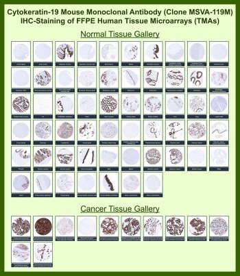 Anti-KRT19 for IHC / Cytokeratin 19, clone MSVA-119M