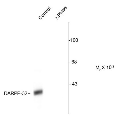 Anti-phospho-DARPP32 (Thr34)