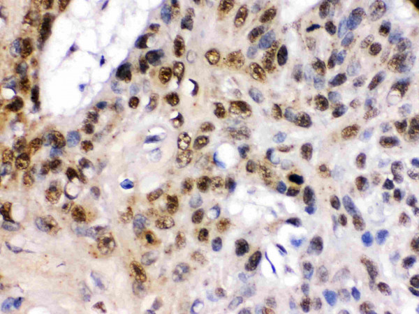 Anti-TCF7L1 / TCF3