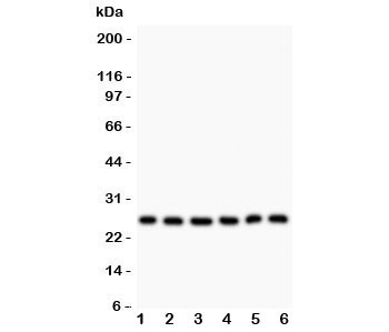 Anti-Galectin 3