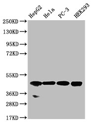 Anti-NSDHL Recombinant Monoclonal, clone 20F2