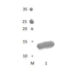 FRMPD4 PDZ Domain