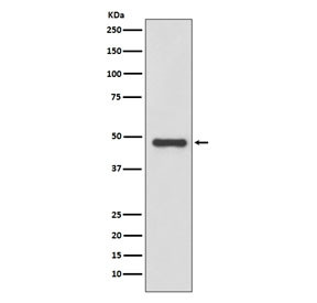 Anti-Urokinase / uPA / PLAU, clone AABC-16