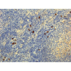 Anti-IgG4 (human), Rabbit Monoclonal (RM120)