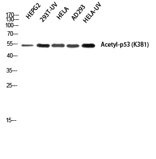 Anti-acetyl-p53 (Lys381)